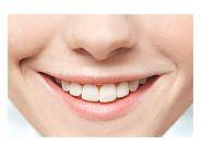 Reconstructia zambetului: fatetele dentare din portelan