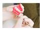 Rezectia apicala – metoda chirurgicala in terapia conservatoare endodontica