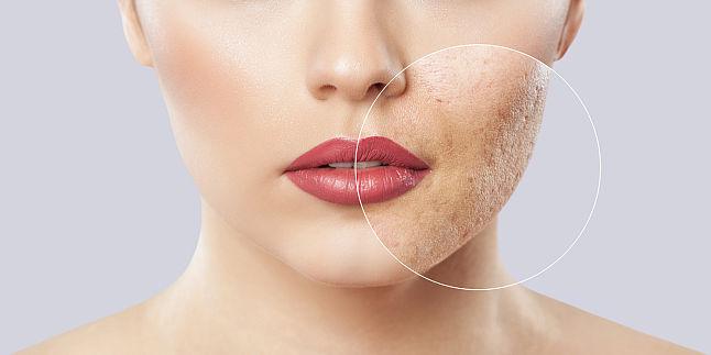 cele mai bune produse de îngrijire a pielii împotriva acneei