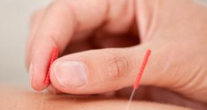 Ce nu stiai despre acupunctura: cum tratezi o boala cu un varf de ac