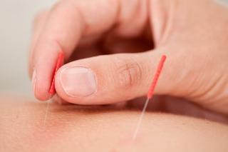 Tratamentul prostatitei cu puncte de acupunctură