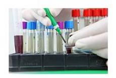 Analize biochimice ale sangelui – modificari ale transaminazelor hepatice