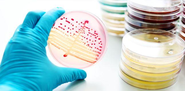 Măsuri pentru prevenirea infecțiilor parazitare Infecţiile nosocomiale
