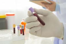 Analize de sange utilizate in patologia hepatica