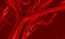 Cum tratam arteriopatia periferica cronica?