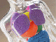 Arsurile gastrice, hernia hiatala si boala  de reflux gastroesofagian (GERD)