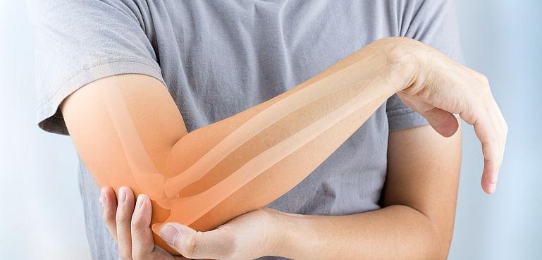 Cea mai dureroasă formă de artrită! Guta – simptome și tratament