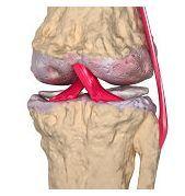 artrita și artroza articulațiilor mari tratamentul artrozei articulației metatarsofalangiene de gradul 2 1