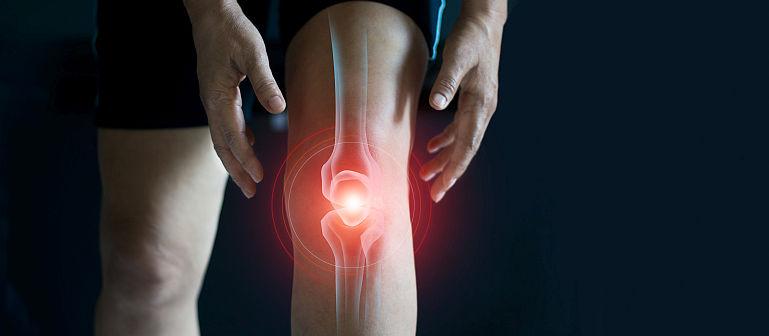 Gonartroza - osteoartrita genunchiului