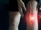 Gonartroza - osteoartrita genunchiului 