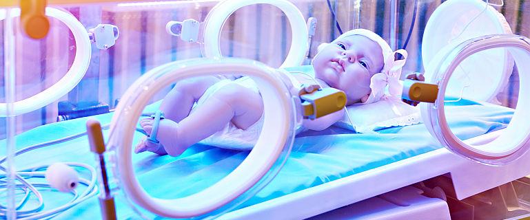 dezvoltarea organelor de vedere la copiii prematuri