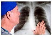 7 simptome ale bolilor pulmonare