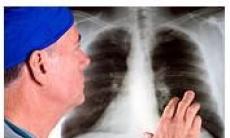 7 simptome ale bolilor pulmonare