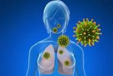 Cancerul pulmonar cu celule mici (microcelular)