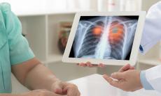 Care sunt simptomele precoce ale cancerului pulmonar?