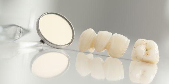 Se pot vindeca cariile dentare de la sine?