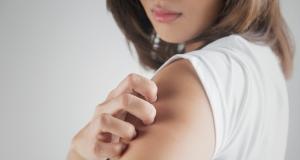 Cum se trateaza dermatita in functie de severitatea afectiunii 