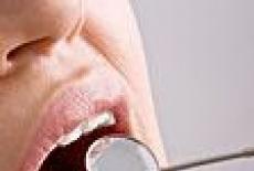 Afla semnificatiile durerilor de dinti