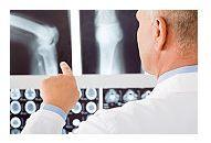 Cum sunt diagnosticate si tratate fracturile osoase