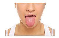 Glosita - inflamatia limbii