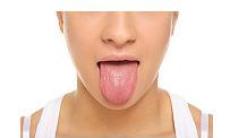 Glosita - inflamatia limbii