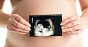 Incompatibilitatea materno - fetala in sistemul Rhesus (Rh)
