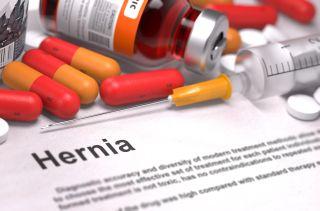 Hernia inghinala – semne, factori de risc, preventie