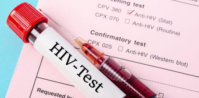 11 semne ale infectiei cu HIV