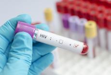 Simptomele infectiei cu HIV la femei