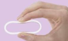 Metode de contraceptie moderne: inelul contraceptiv vaginal
