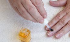 Cum poti restabili aspectul sanatos al unghiilor