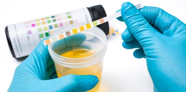 Care sunt cauzele infectiilor urinare frecvente?