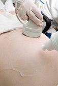 Diabetul zaharat gestational (de sarcina)