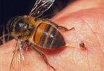 Intepatura de viespi/albine la copii