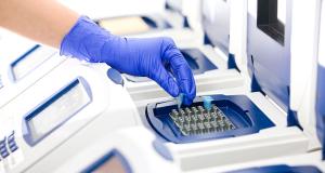 MedLife a identificat 46 de cazuri noi de infectare cu subvarianta BA.2 in urma procesului de secventiere a 171 de probe