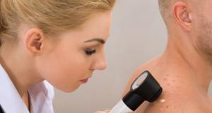 Cancerul de piele: melanomul malign