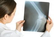 20 octombrie - Ziua Internationala a Osteoporozei