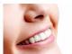 Ortodontia la adulti