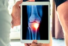 osteoartrita moderată a genunchiului osteoartrita articulației gleznei tratament de 2 grade