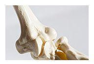 Osteoporoza, o problema majora de sanatate