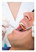 Parodontita sau boala parodontala