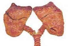 Abcesul pulmonar 