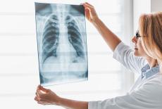 Cand se realizeaza transplantul pulmonar?