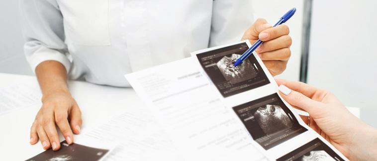 Ce trebuie sa stim despre polipii uterini cu Dr. Laura Mustata, medic specialist obstetrica-ginecologie