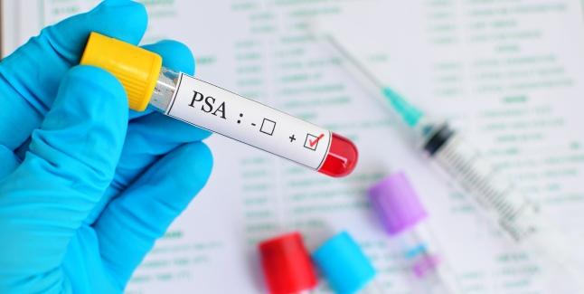 Antigen specific prostatic - PSA si free-PSA