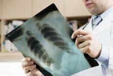 Radiografia pulmonara - cand este recomandata si de ce?