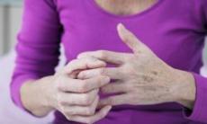 Reumatismul abarticular: simptome, cauze si solutii de tratament