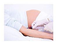 Sensibilizarea la antigenul Rh in timpul sarcinii