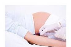 Sensibilizarea la antigenul Rh in timpul sarcinii