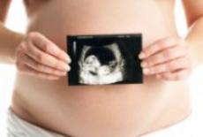 Stabilirea varstei fetale